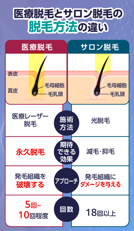 医療脱毛は永久脱毛を期待できるがサロンはできない！脱毛方法の違い