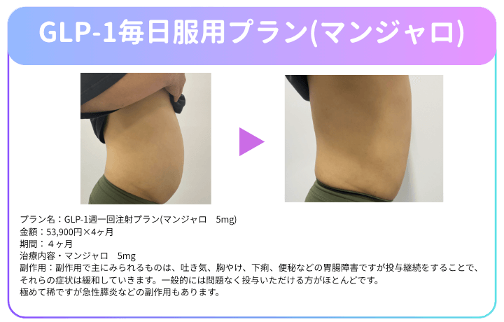 DMMオンラインクリニックのマンジャロの症例画像